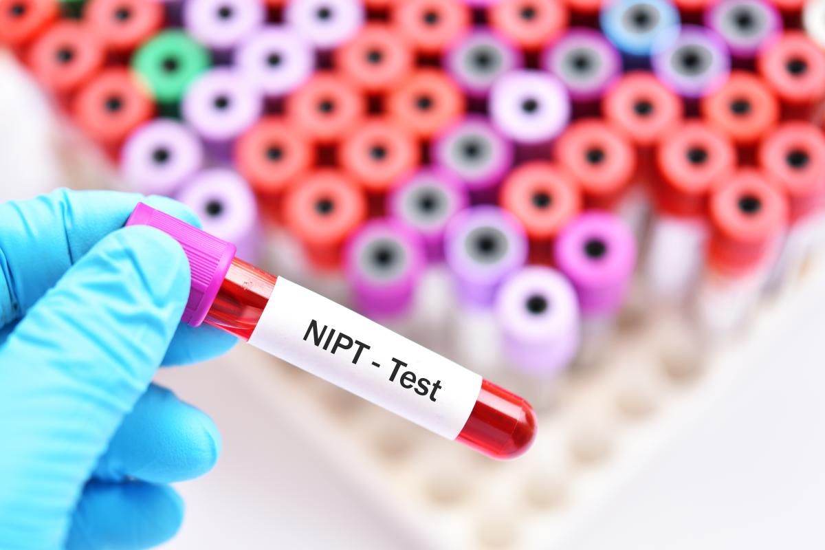 Nipt test in bloedbuisje