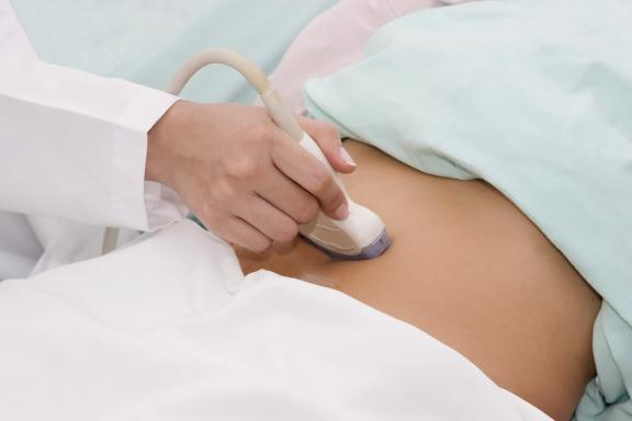 Zwangere vrouw die een echoscopie ondergaat